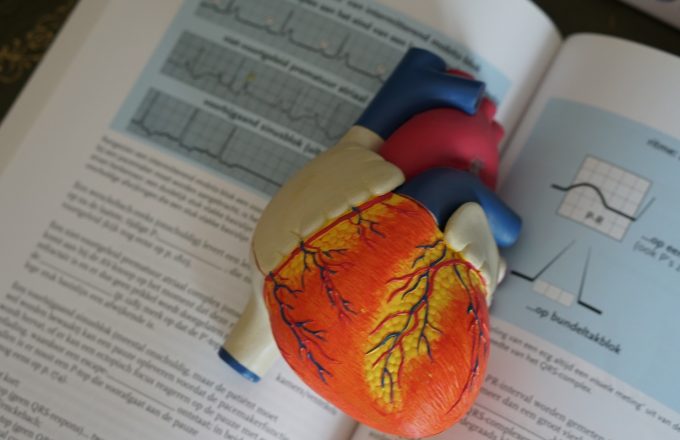 &#8216;How-to&#8217; guide launched to speed up spread of ‘game-changing’ stroke treatment