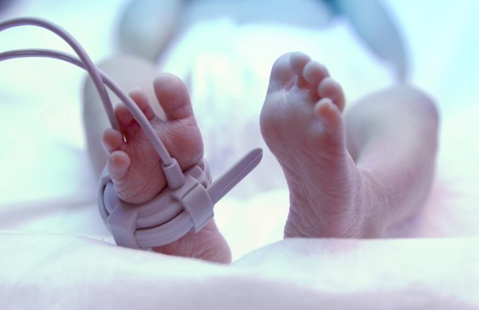 Feet of a premature new born baby under ultraviolet lamp